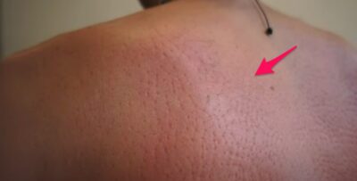 shakti mat does it work for back pain